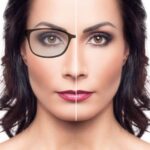 Lasik Treatment